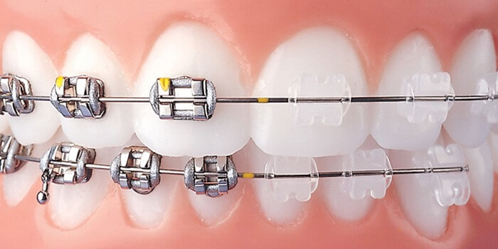 ortodonti.jpg