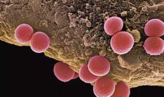 Staphylococcus aureus