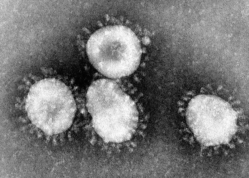 SARS koronavirüs parçacıklarının elektron mikroskobu görüntüsü