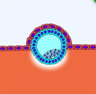 Blastula