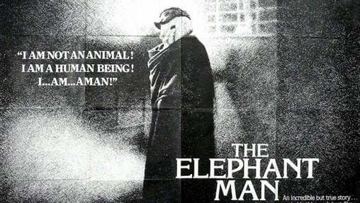 elephant man