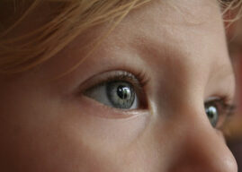 Çocuklarda Göz Kapağı İltihabı (Blefarit) Belirtileri ve Diğer Göz Kapağı Hastalıkları