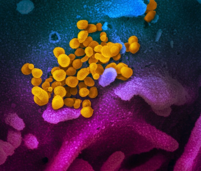 Koronavirüs mikroskop görüntüsü