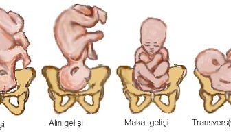 Bebek Geliş Pozisyonları
