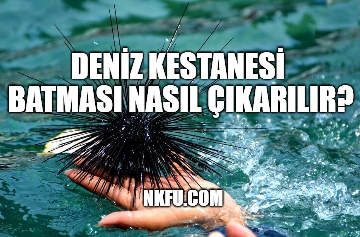 deniz kestanesi batması nasıl çıkarılır?