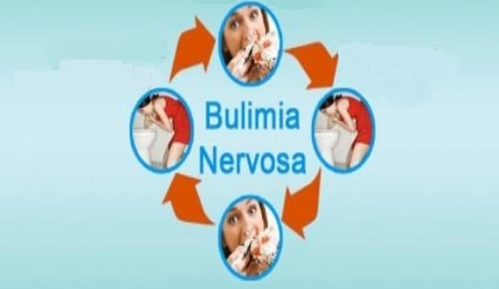 Bulimia Nervoza