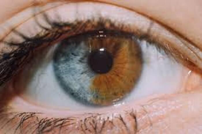 iki renkli göz