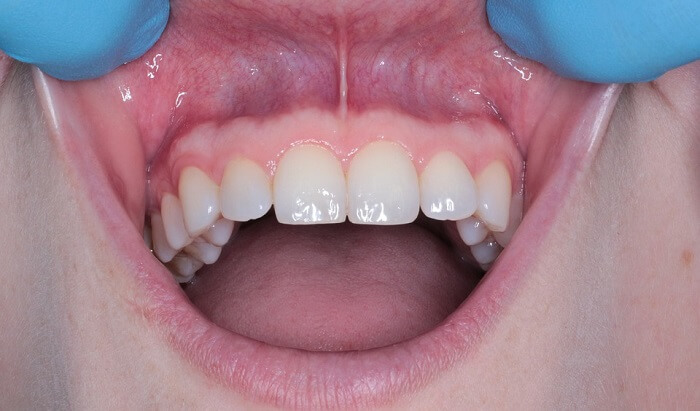 diş bakımı